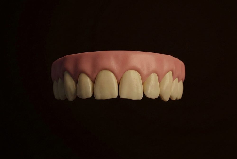 Natural teeth before veneers, conceptual